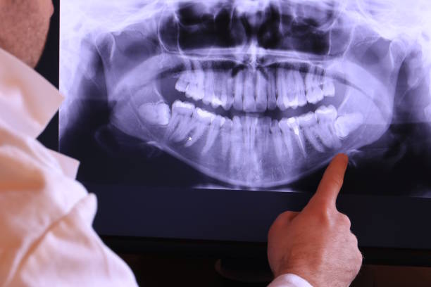 Best Emergency Treatment for Toothache in La Crescenta Montrose, CA